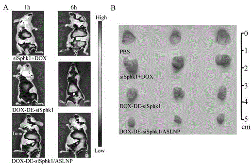 一种用于乳腺癌治疗的siSphk1-DOX共递送靶向纳米制剂及其制备方法和应用