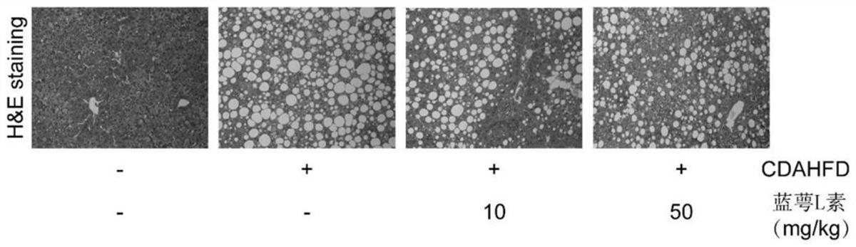 蓝萼L素在制备预防或治疗非酒精性脂肪肝炎药物中的应用