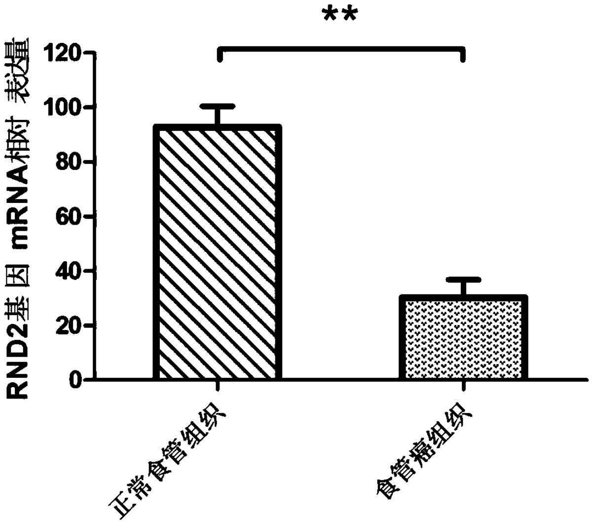 一种食管癌检测、诊断或者预后评价制剂，治疗食管癌的药物及RND2基因的应用