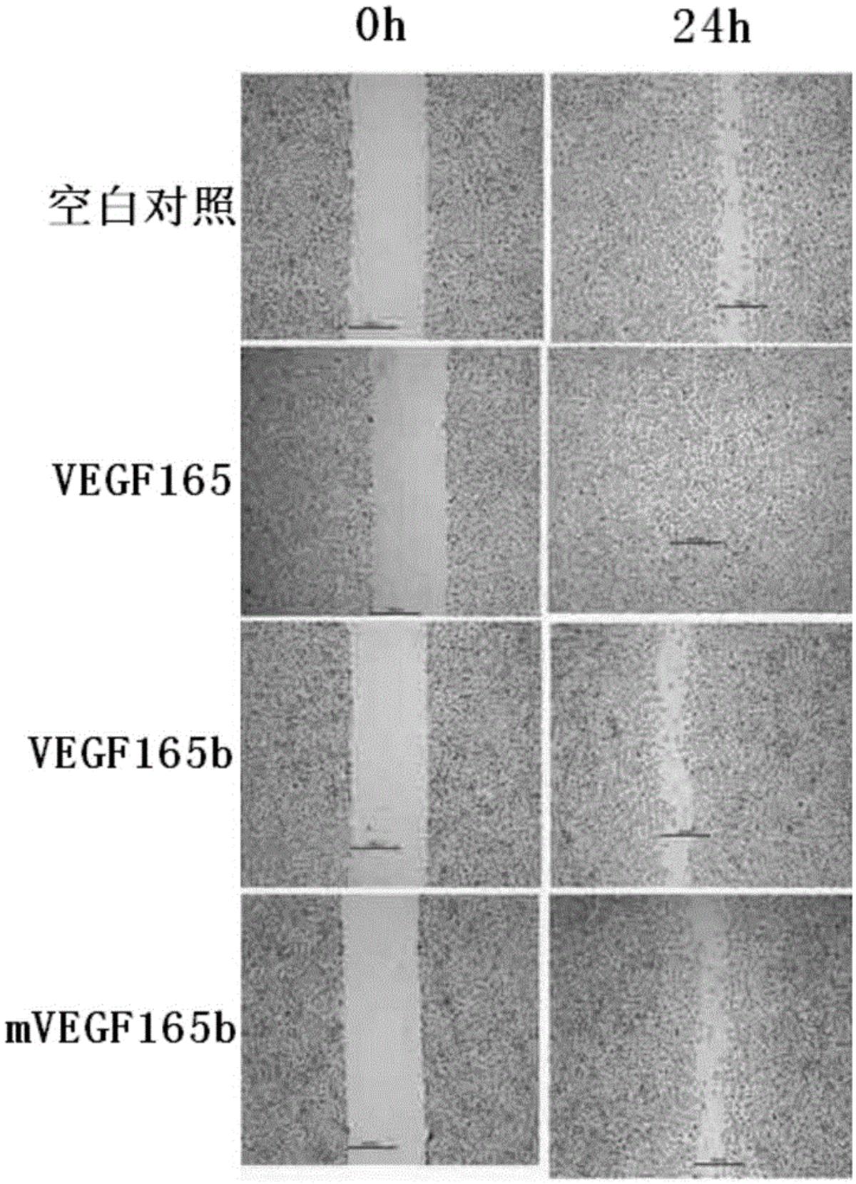 VEGF165b突变体及其制备方法和应用